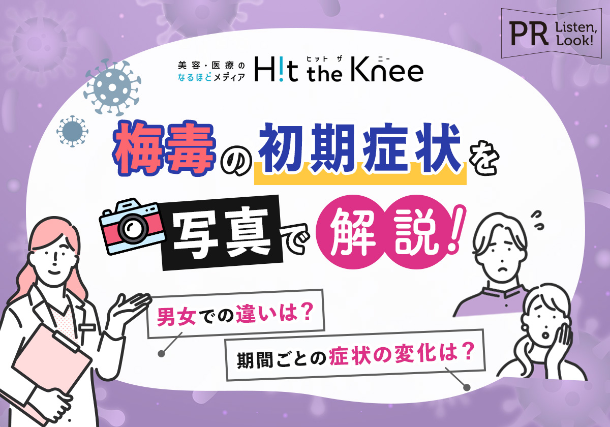 性感染症 厚生労働省