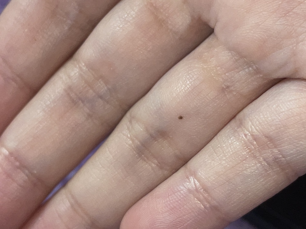 手相占い 手のひらにホクロがある人は要注意。位置によって対策を卯野たまごの空気を読まず手相を読むmi-mollet ミモレ明日の私へ、小さな一歩！ 2 2