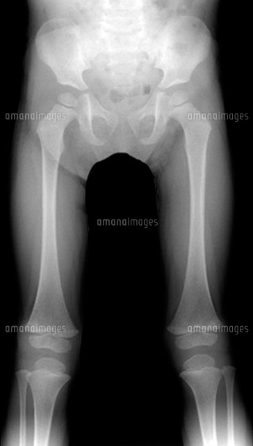 レントゲン下半身画像TikTok