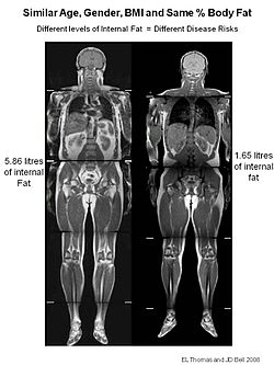 Visual Anatomy 視覚解剖学