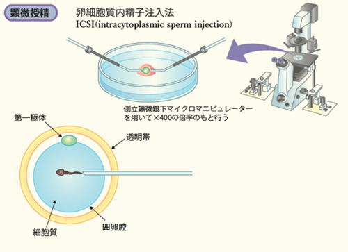 採卵から妊娠判定まで赤坂レディースクリニック東京都港区