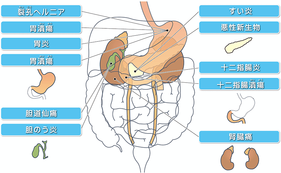 1.腹痛の原因となる病気は？急にお腹が痛くなったら 一般の方へ日本臨床外科学会
