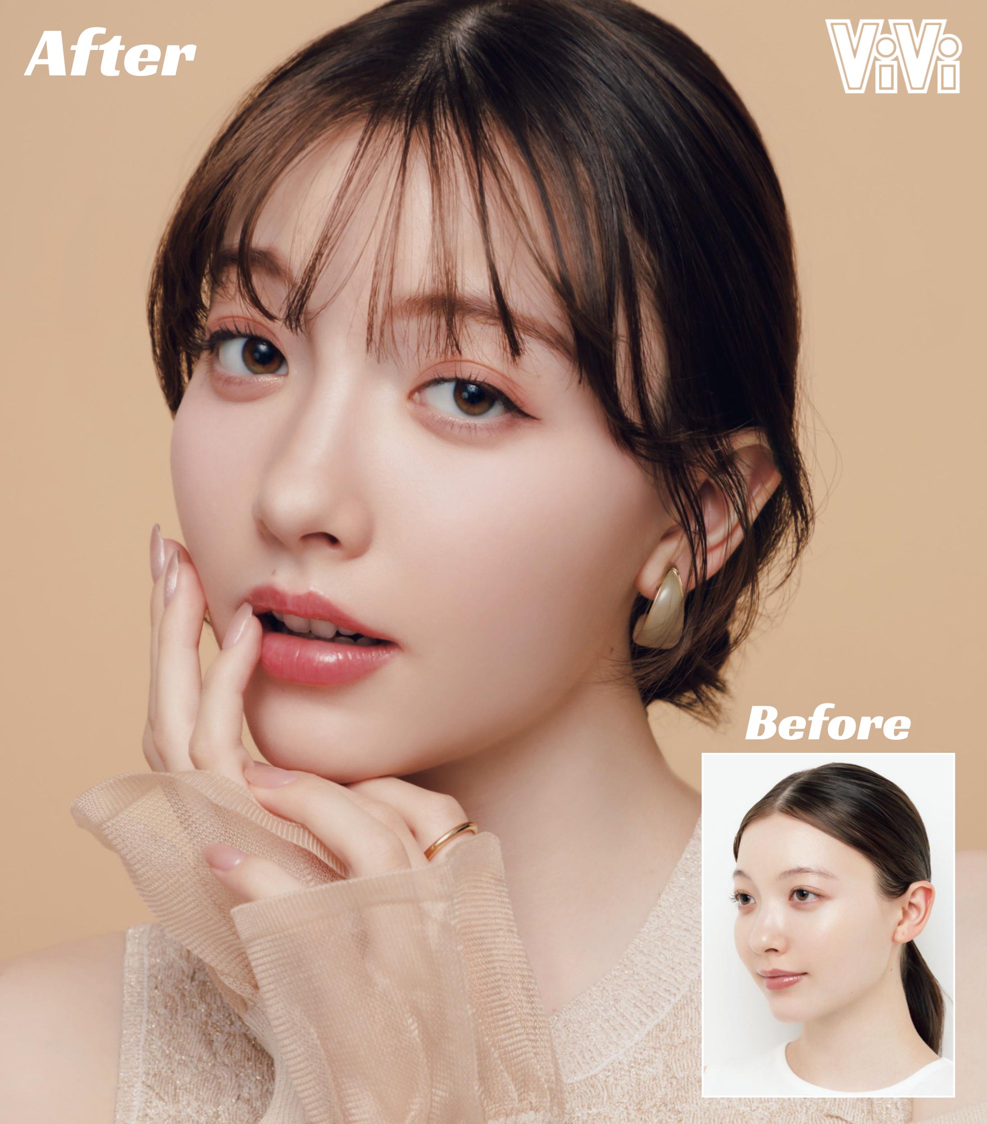 Matt マット の整形箇所は4つ!?過去昔と今の写真画像を比較！高須医院長の徹底分析！ - ワサガシ