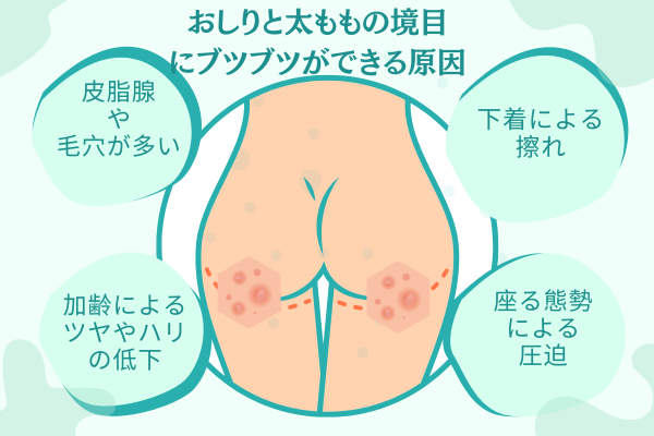 膿痂疹野田市 小児科 千葉県 こどもの花粉症 こどもの漢方 喘息 アトピー性皮膚炎 アレルギー 結節性痒疹 たんぽぽこどもクリニック