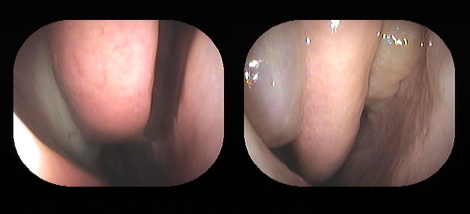 痛くないできものが治らない考えられる疾患は？千里皮膚科