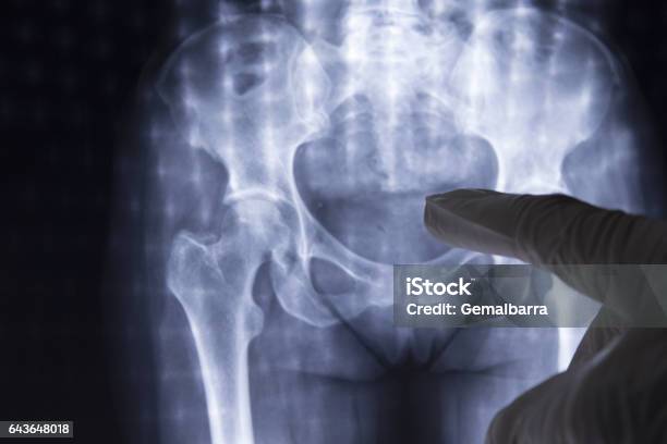 山口 浩司 先生ひざの痛みをがまんし続けるのはもったいない！ 診察とレントゲン検査で見るポイント人工関節ドットコム