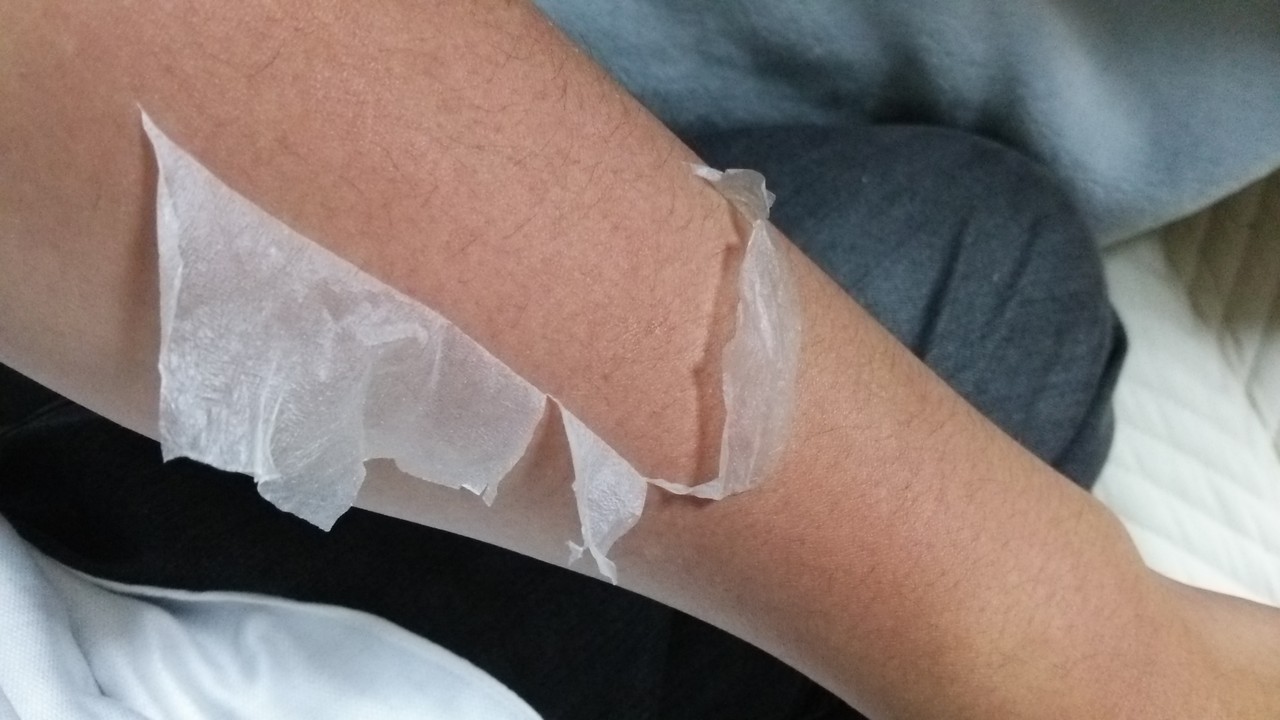 日焼けで皮がむけるのはなぜ？理由とアフターケアの方法を解説田辺三菱製薬ヒフノコトサイト