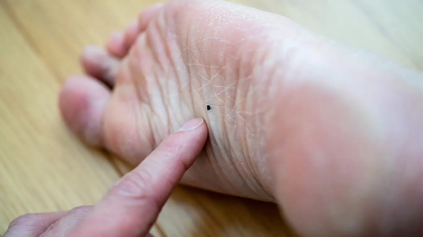 皮膚がんの生存率はどのくらい？症状や検査方法についても解説がん遺伝子医療専門 GENEクリニックグループ