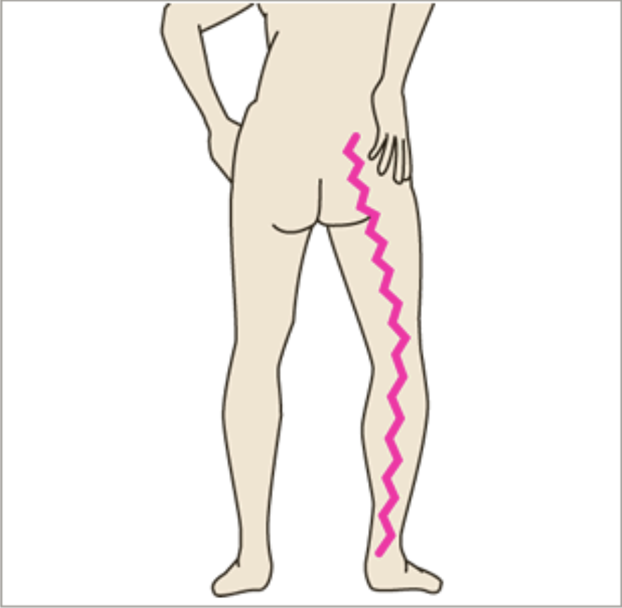 ドクター千賀 ふとももの痛み