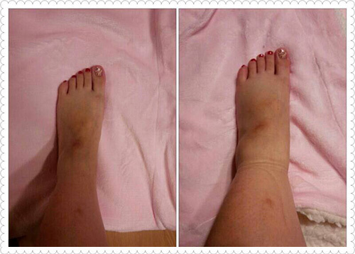 妊娠中 足が太くならない方法TikTok