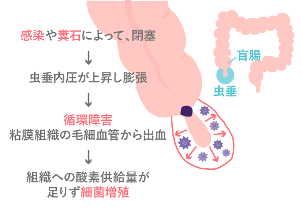 １８歳女子高校生 脂肪の塊ができる原因不明の病気と闘う「病気を知ってほしい」