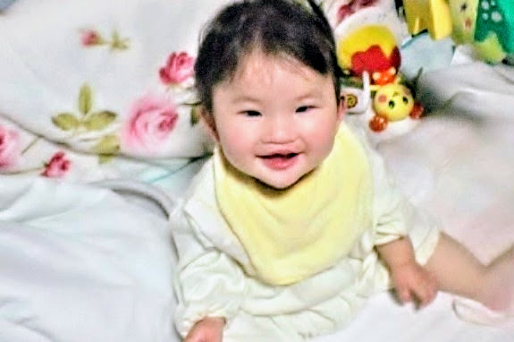 口唇裂・口蓋裂慶應義塾大学医学部 形成外科