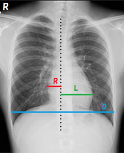 最近お腹の調子が悪いねん。」～お腹のレントゲン写真のご紹介～ – みどり病院神戸市、明石市、循環器、透析