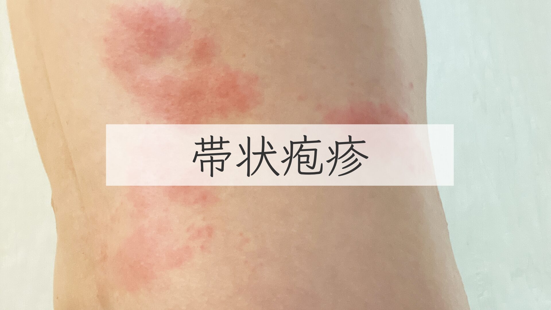 糖尿病による皮膚トラブルを回避するためのフットケアとは？やり方を紹介