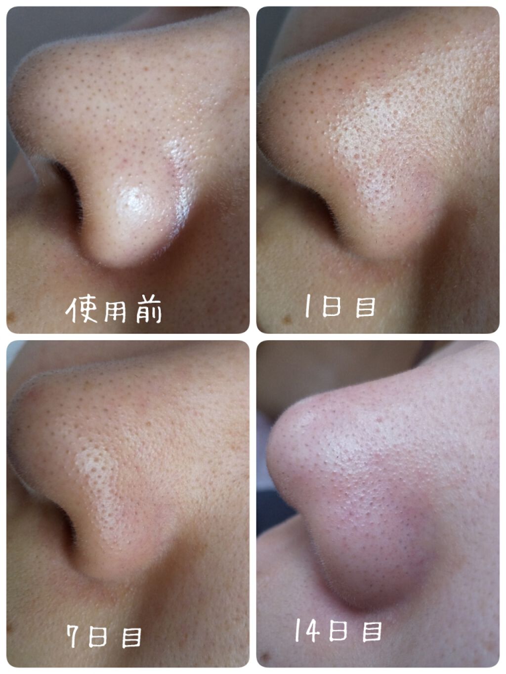 お悩み解決にも☆ ベストコスメ殿堂入りのヒミツ研究室vol.09「無印良品 ホホバオイル」その2美容・化粧品情報はアットコスメ