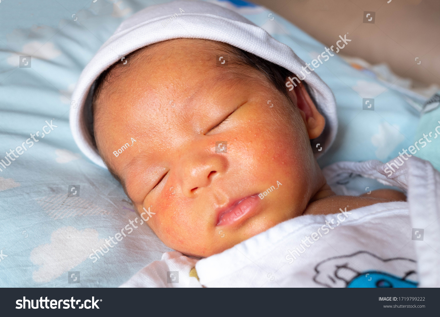 赤ちゃんの肌が黄色い これって黄疸？ - 小児科オンラインジャーナル