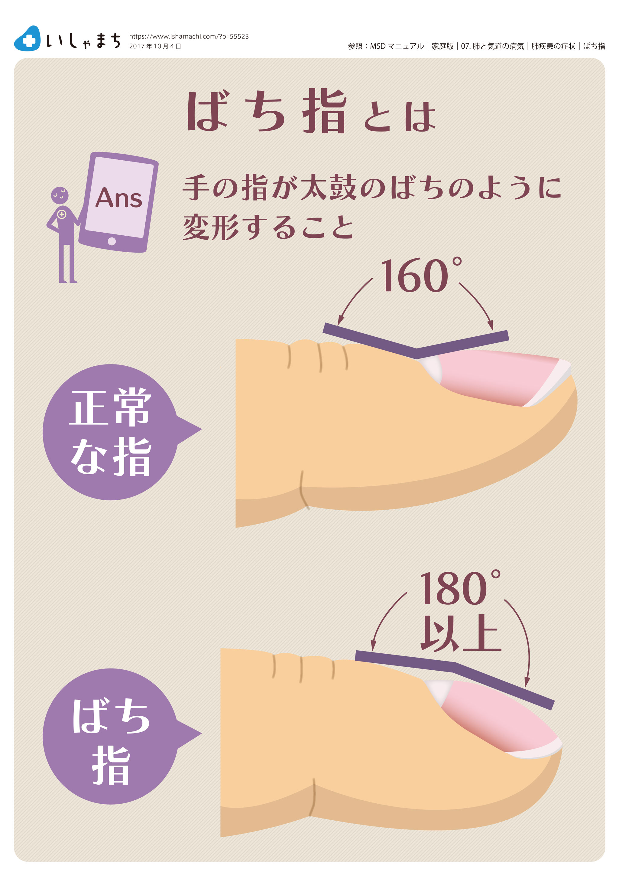 ばち指で考える疾患は？ : 今日なに読もう〜病院総合診療医の論文ブログ