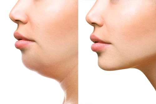 顔の筋トレ方法まとめパーツ別で美しさを手に入れる