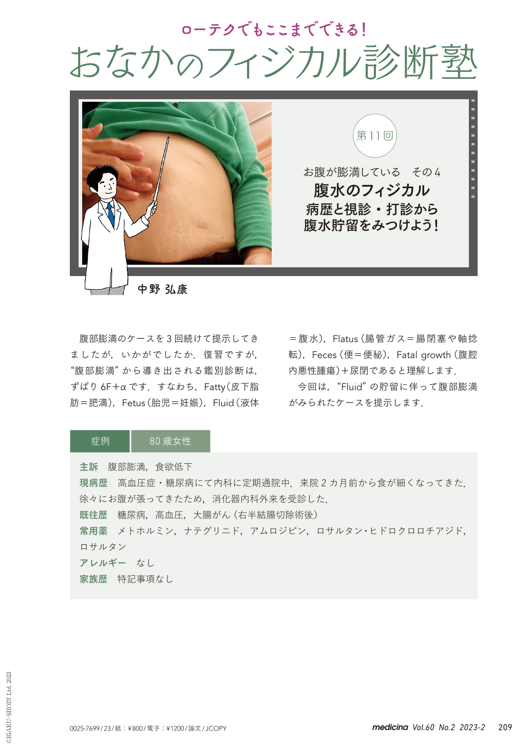 Q&A Vol.508水の移動と波動がポイント 腹水のアセスメントに関するQ&A日本離床学会