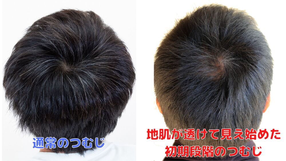 つむじはげの写真・画像素材 - Snapmart スナップマート