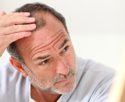 前髪スカ男必見！前頭部が薄毛でも似合うカッコいいメンズ髪型18選