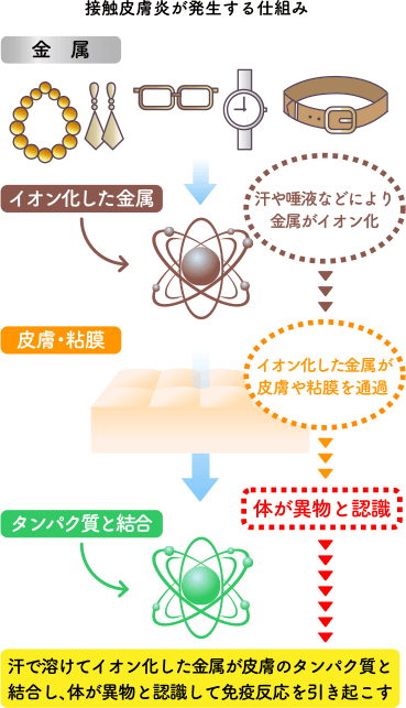 蕁麻疹 じんましん新鎌ケ谷くぼた皮膚科泌尿器科鎌ケ谷市の皮膚科・泌尿器科