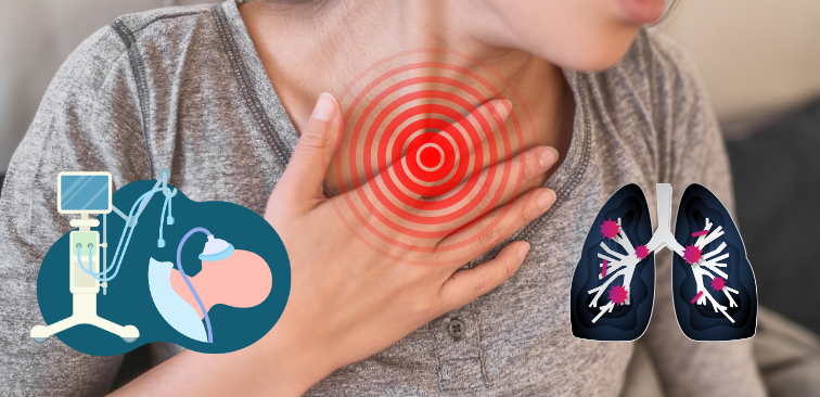 無気肺」の744点のロイヤリティフリー画像、写真素材、絵Shutterstock