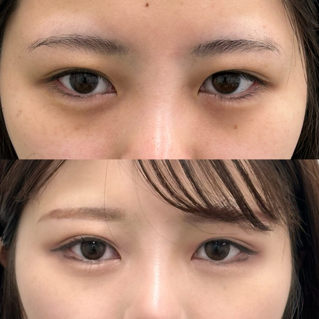 寝起きのクマ、TikTok