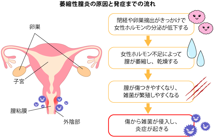 なんか下のほうが腫れぼったい 」まさかこんなところにも！？妊娠中にあらわれた体 ベビーカレンダ