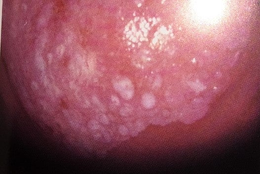 コルポスコープ勉強会医療法人 大川産婦人科病院