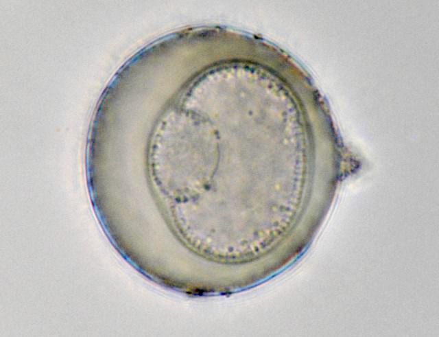 ミクロな世界「花粉」のユニークな姿 顕微鏡画像を無料公開毎日新聞