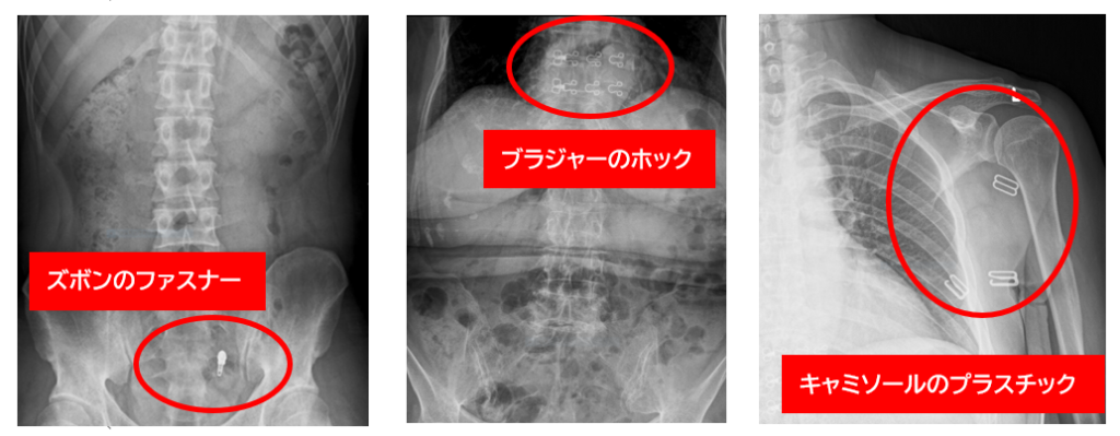 幼児の脚と骨盤骨 01808015724B の写真・イラスト素材アマナイメージズ