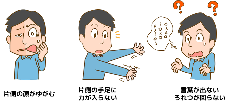 診察室から＞脳卒中を疑う３つの症状とは？ 突然発症、顔や手のまひ、言語障害暮らし・文化佐賀県のニュース佐賀新聞