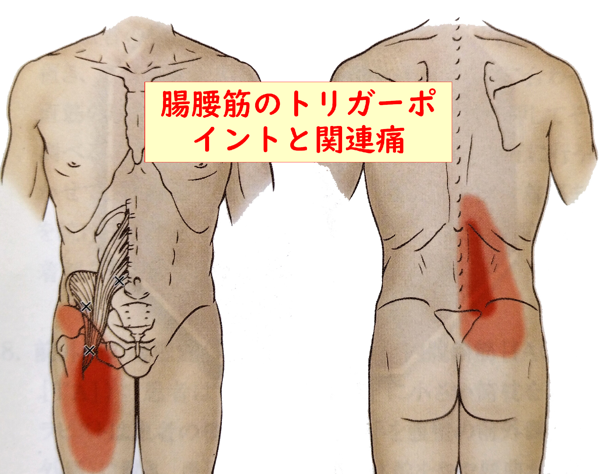 腰に負担をかけずにアップドッグを深める方法とは - スポーツナビ