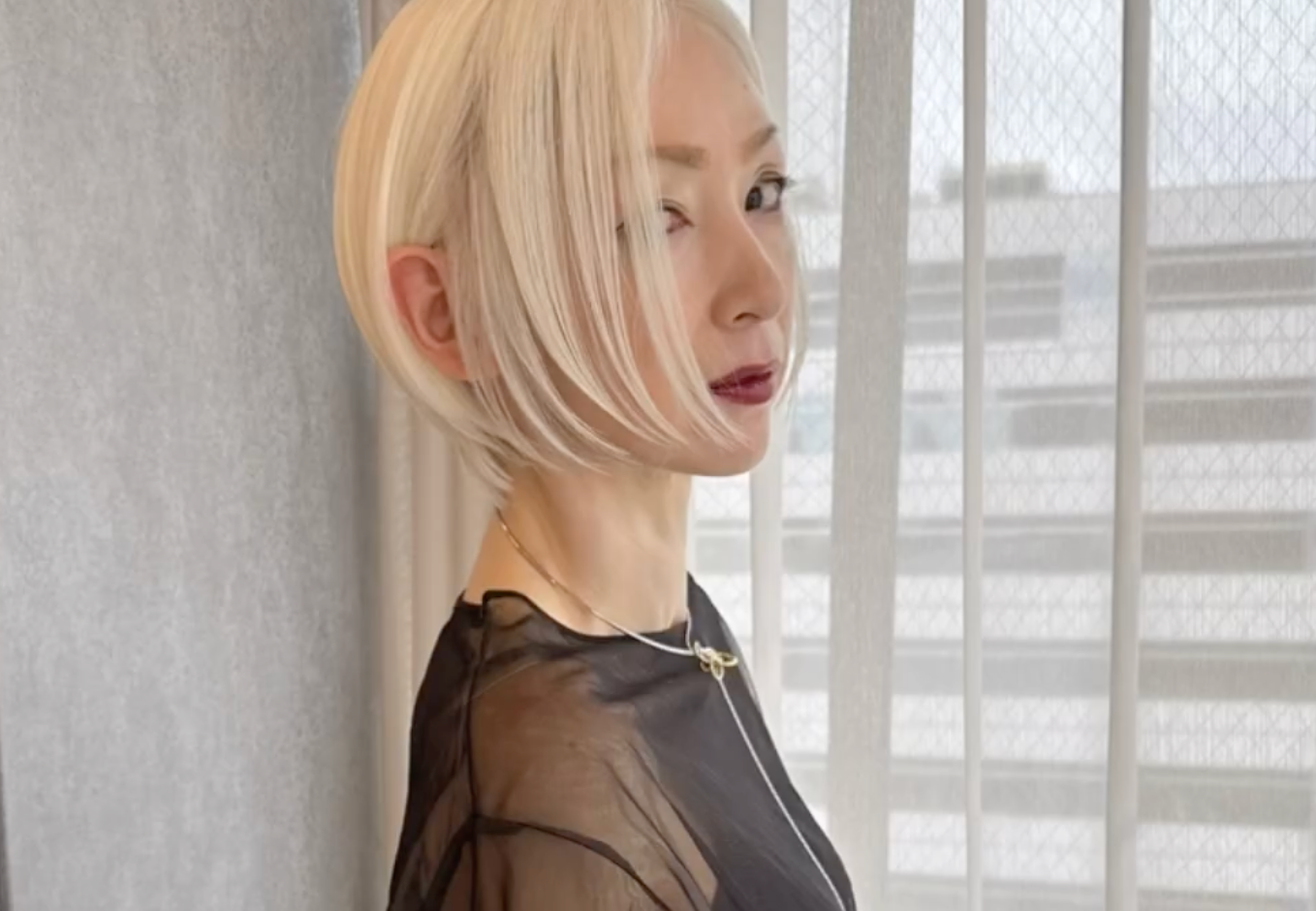 顔がまだらに「二度見されることもあったけど 」 10代発症、45歳で再発した「尋常性白斑」、今は美しい白髪で話題にまいどなニュース