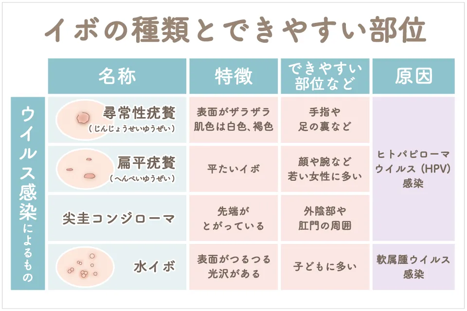 ほくろ・イボ - 東京・六本木の美容皮膚科なら今泉スキンクリニック