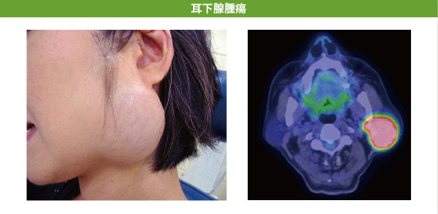 眼科 - 鹿児島県がん診療連携拠点病院