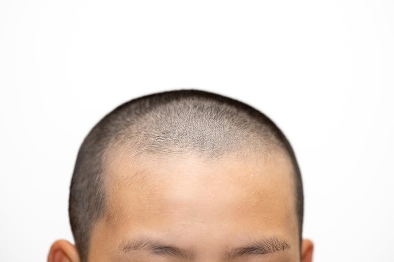 前髪が薄いなら試してみて 目立たないヘアスタイル＆カバー方法美的.com