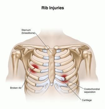 桃アレルギーの症状とは？アレルギーについて正しく知り、適切に対処しよう - くふう トクバイニュース