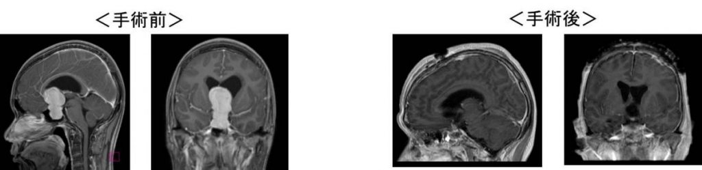 劇場版ドクターX」ナレーター・田口トモロヲが本編出演、八木莉可子と伊東四朗も参加 コメントあり写真20枚- 映画ナタリ
