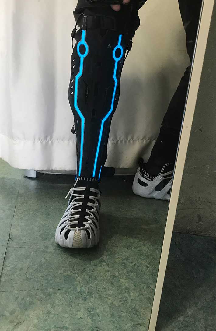 ここまで進化した、SF的・超現実的だったりする義足・義手 - mirojoan's Blog