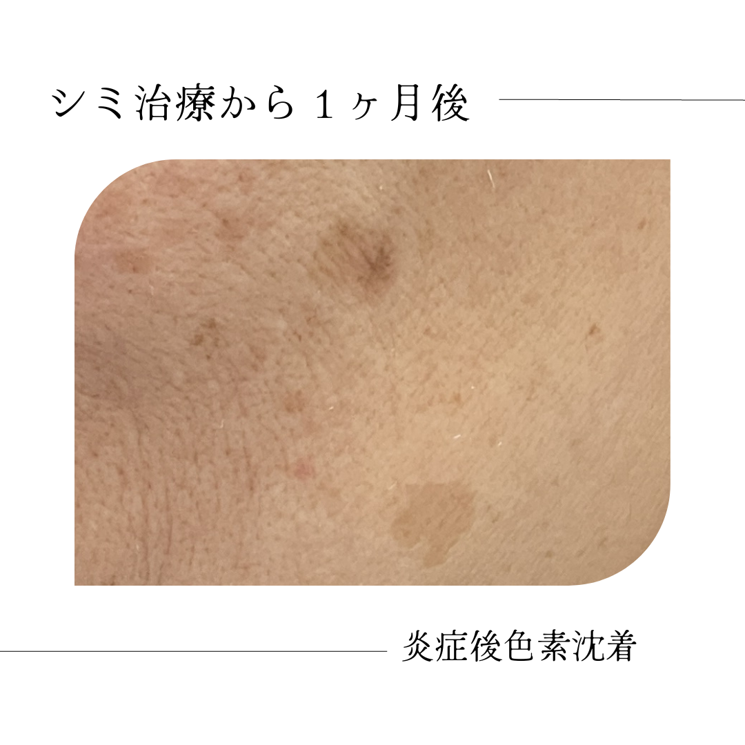 レーザー治療美容皮膚科・スキンケアなら城本クリニック