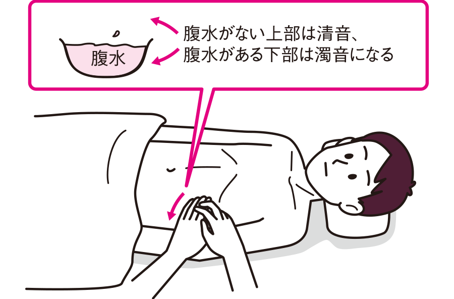肝硬変の看護計画原因、症状、観察項目から見る看護過程、看護問題ナースのヒント