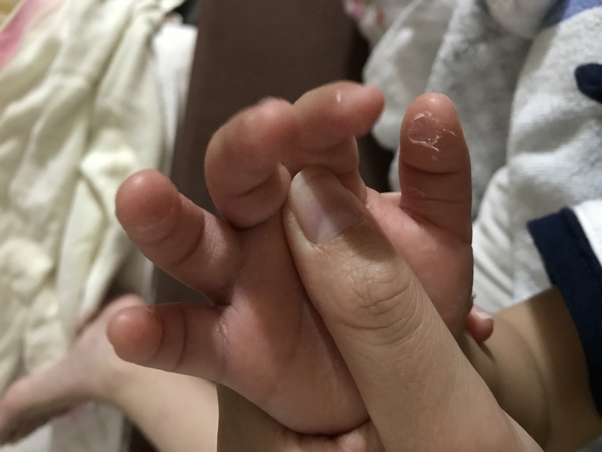 新生児の肌荒れ・皮むけ、どう防ぐ？－沐浴＆保湿ケア方法を動画で学ぼう―ナチュラルサイエンス for Mama & Kids Smile