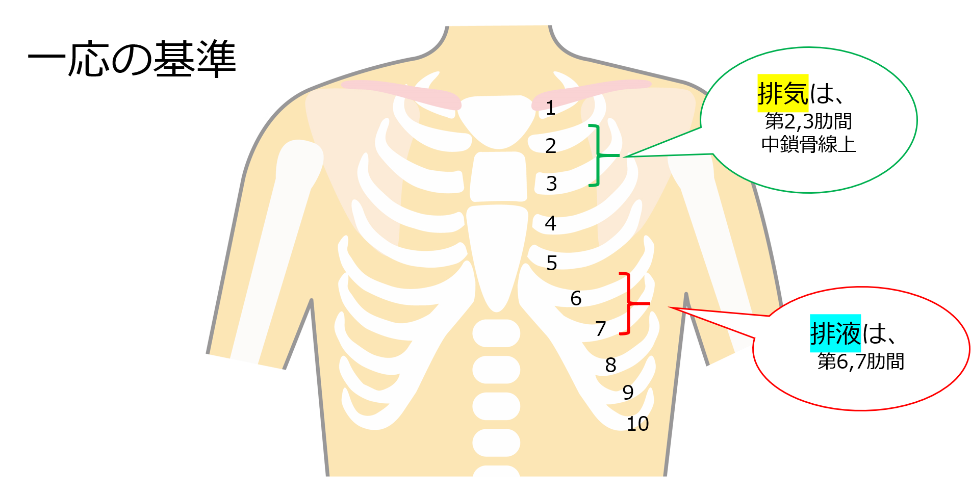 はじめての胸腔ドレナージ！-注意すべきことは？-Antaa Slide