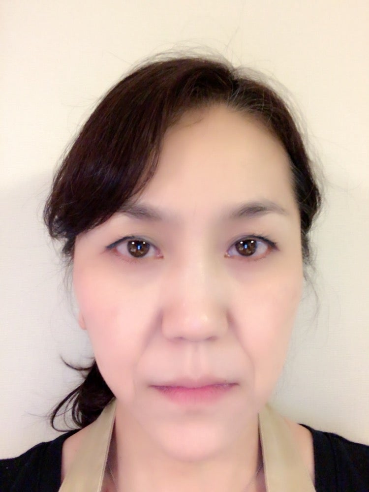 くしゃっとした笑顔の作り方2025 年のリアルなLemon8ユーザー体験