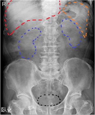 一般撮影千葉大学医学部附属病院 放射線部