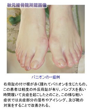 原因は手指の使い過ぎ！再発したくない人のための腱鞘炎の治し方 - CureCare キュアケア痛みの改善から予防までを届けるメディア