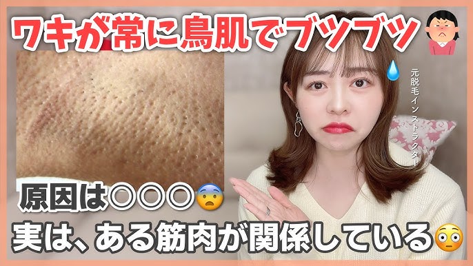 脇 ワキ のブツブツは黒ずみの前兆？ブツブツ毛穴をなくして、きれいな脇を目指しませんか美容皮膚科 銀座よしえクリニック 公式 東京