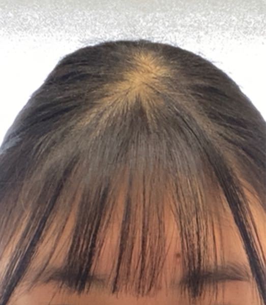 髪の毛を結ぶと頭が痛くなりませんか？Official Blog Rue Do'r2024.04.18髪質改善ヘアエステ専門店 -お役立ちサイト なびぽ 尾張旭・瀬戸・長久手